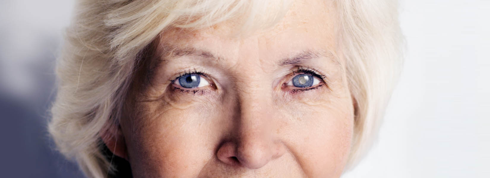 Cataract Surgery in Glenview